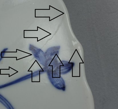 2010198 "V-shaped" hairline (close up)